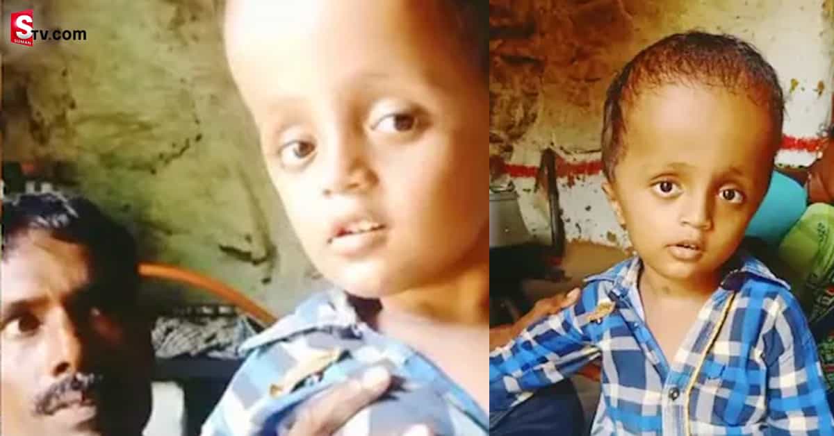 ఆరేళ్ళ పిల్లాడికి వింత వ్యాధి. తల పెరిగిపోతూ.. పాపం