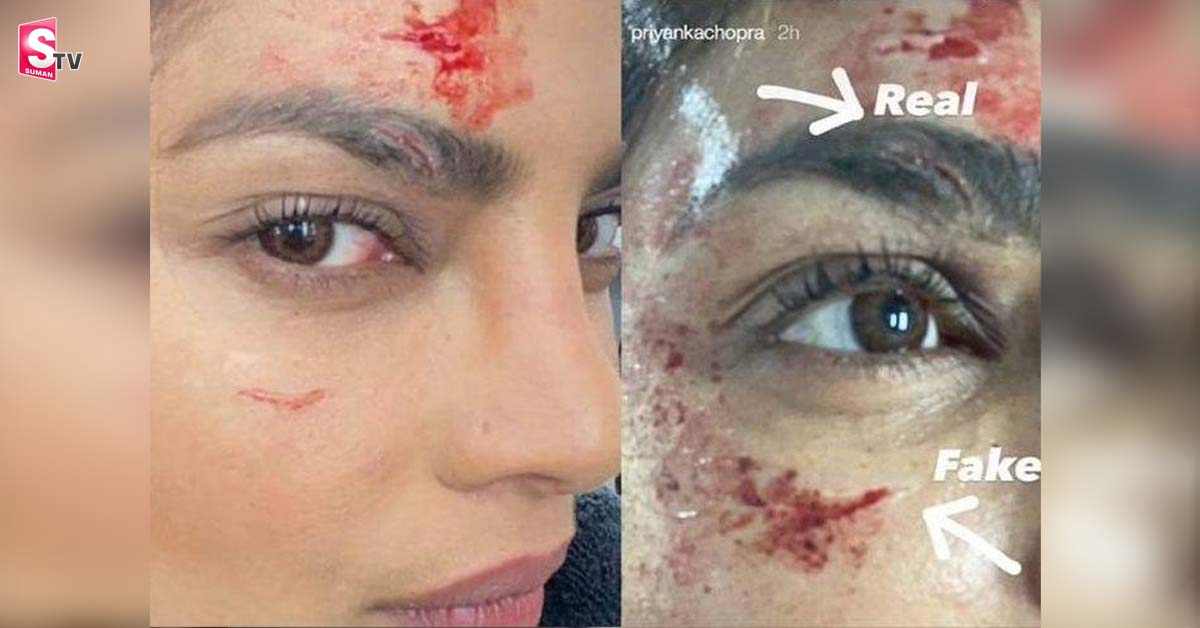 ప్రియాంక చోప్రా కి షూటింగ్ లో గాయాలు?? ఎంతవరకూ నిజం??!