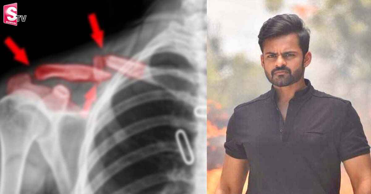 సాయిధరమ్‌ తేజ్‌ కాలర్‌ బోన్‌ సర్జరీ ఎప్పుడంటే?