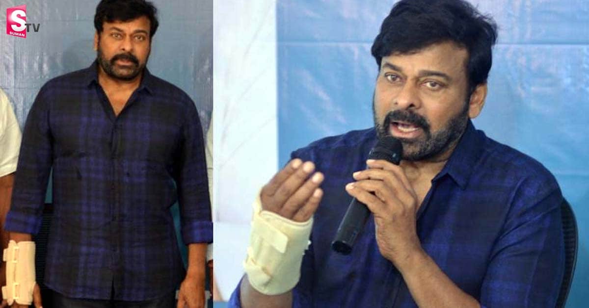 మెగాస్టార్ చిరంజీవి కుడి చేతికి సర్జరీ!