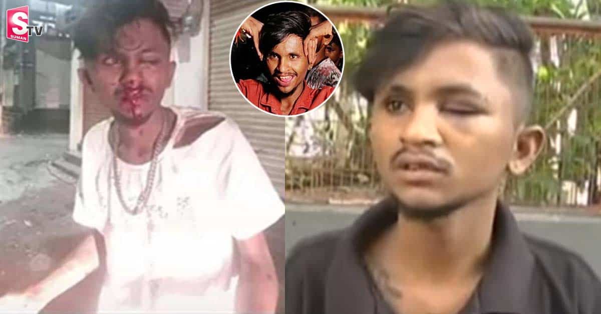 15 మంది ఇష్టమొచ్చినట్లు కొట్టారు.. తనపై దాడి చేసింది ఎవరో బయటపెట్టిన సుఖీభవ శరత్