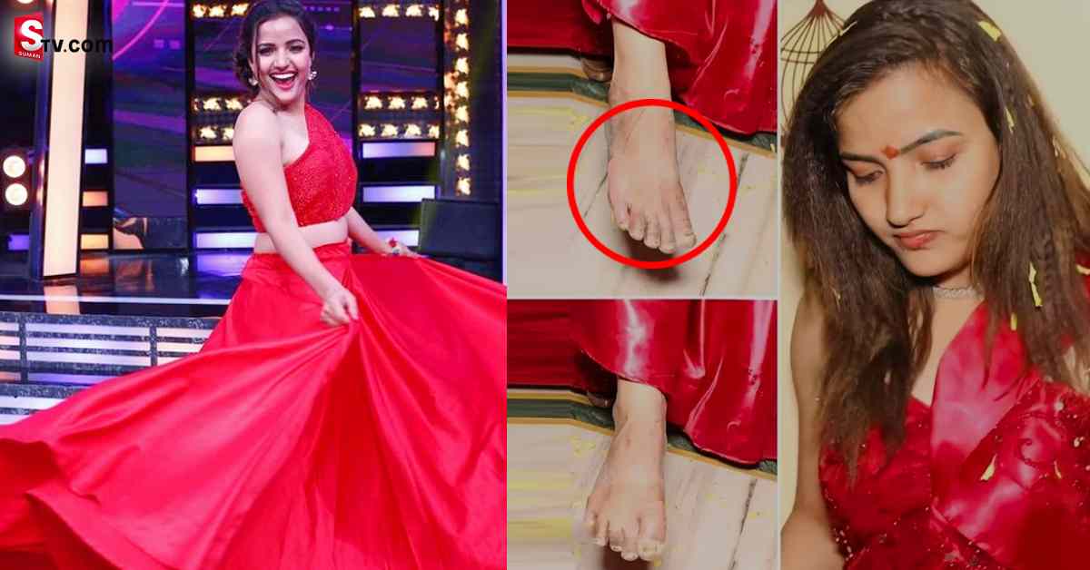 సిరి హన్మంత్ కు తీవ్ర గాయాలు! ఏమైందంటే?
