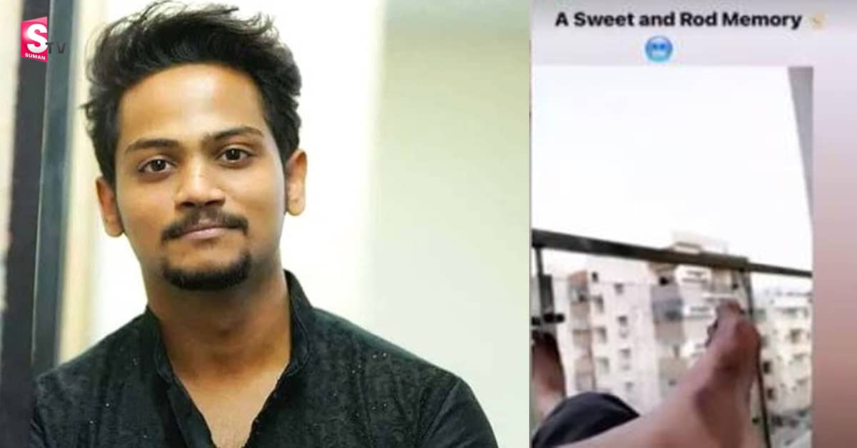 బిగ్‌బాస్‌ కంటెస్టెంట్ షణ్ముఖ్‌ కాలికి గాయం
