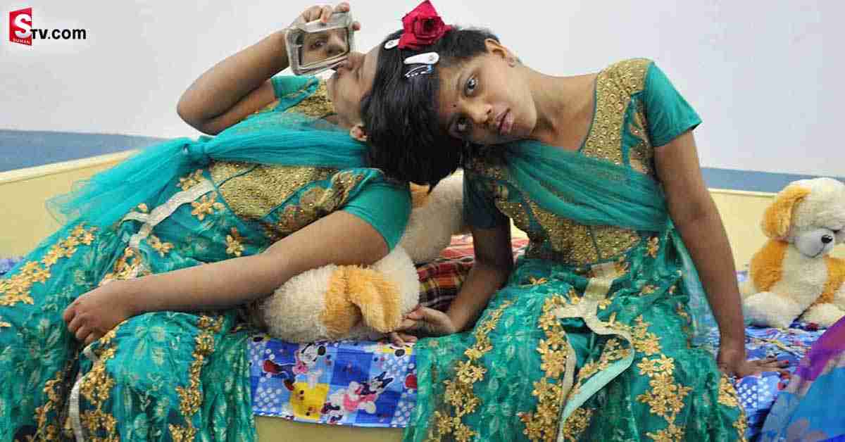ఆపరేషన్‌ చేస్తే వీణా-వాణీలకు ముప్పు.. హైకోర్టుకు తెలిపిన వైద్యులు