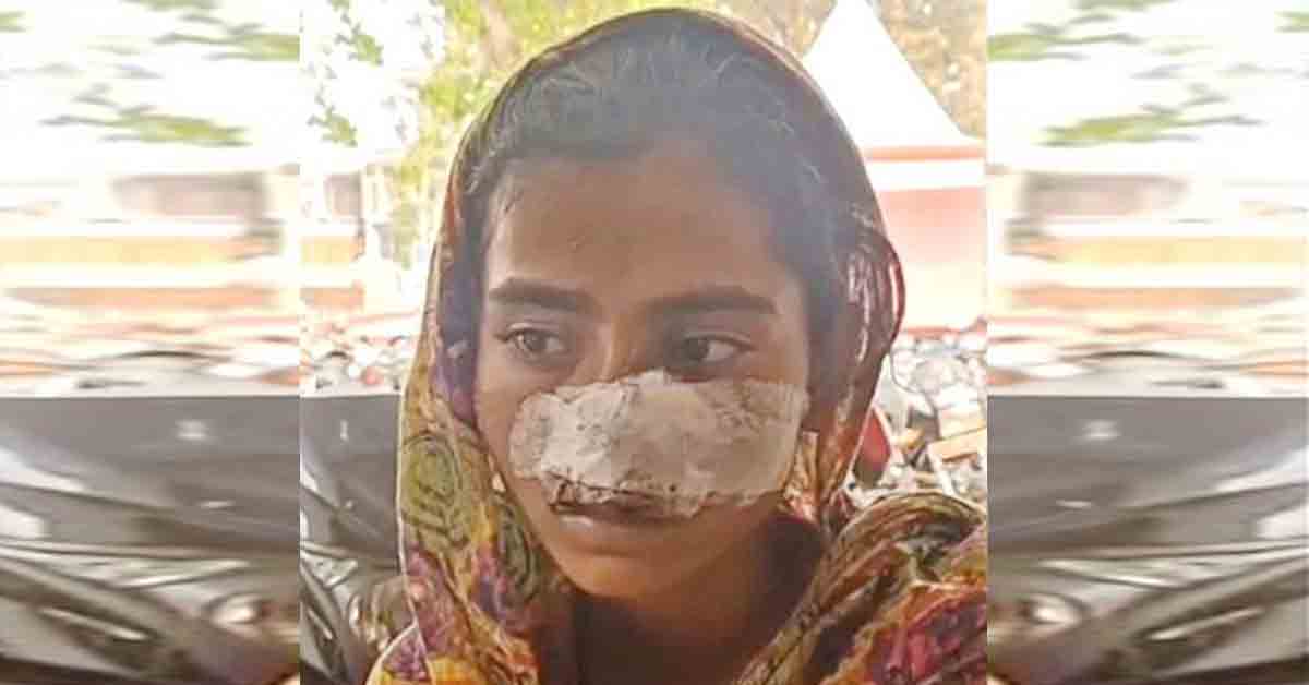 సర్పంచ్‌ క్రూరత్వం… ధర్నా చేసినందుకు ముక్కు కోసేశాడు
