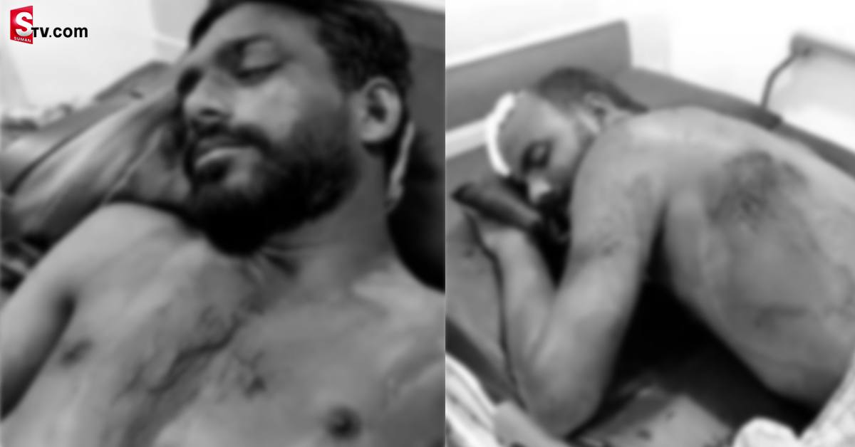 చికెన్‌ మంచిది ఇవ్వలేదని ఓనర్‌పై రాళ్లు, కర్రలతో ఎటాక్!