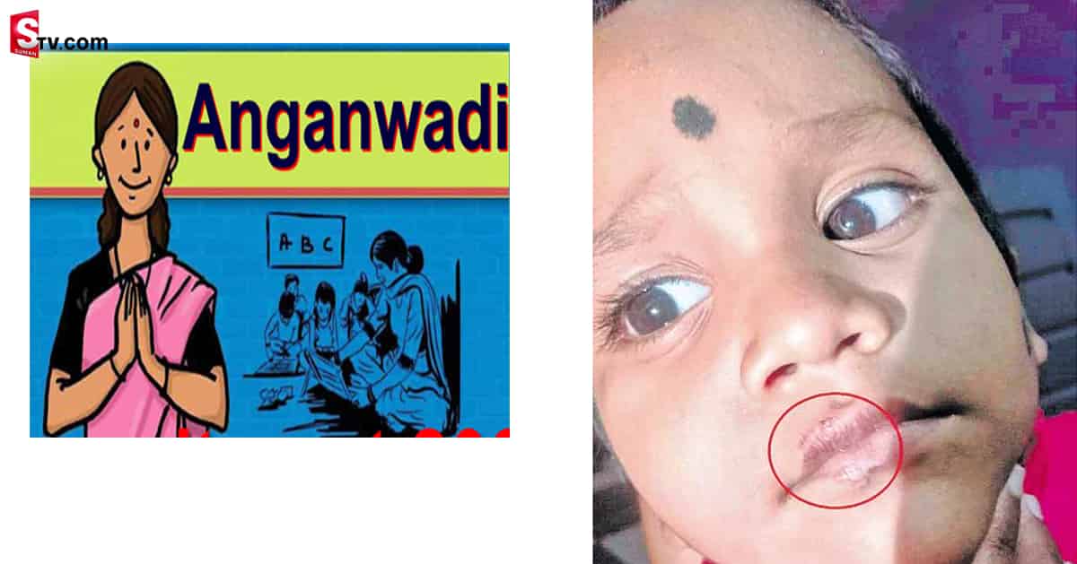 ఏడుస్తున్నాడని పసివాడిపై అంగన్ వాడీ ఆయా అకృత్యం!