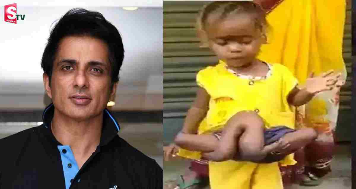 Sonu Sood: చిన్నారికి నాలుగు చేతులు, కాళ్లు.. మరోసారి మానవత్వం చాటుకున్న సోనూసూద్