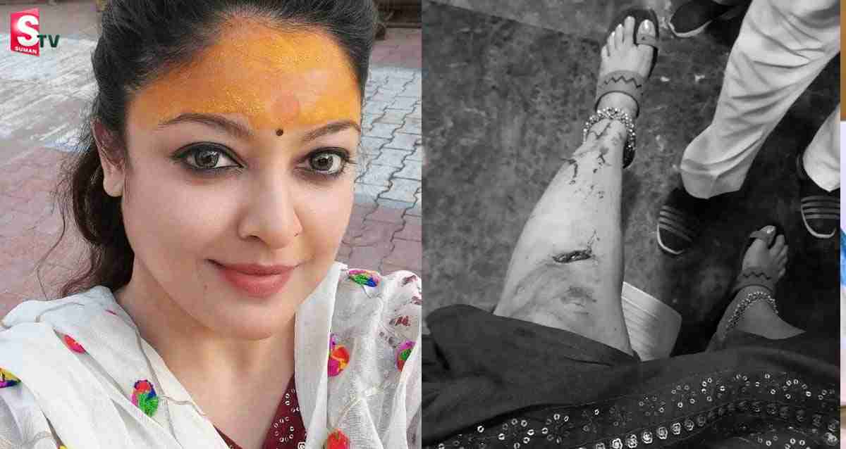 రోడ్డు ప్రమాదంలో ప్రముఖ నటికి తీవ్ర గాయాలు..!