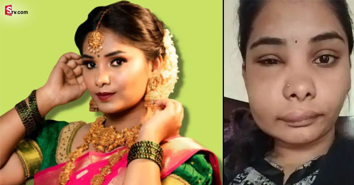 Swathi Sathish: నటి స్వాతి సర్జరీ విషయంలో వెలుగులోకి సంచలన విషయాలు..