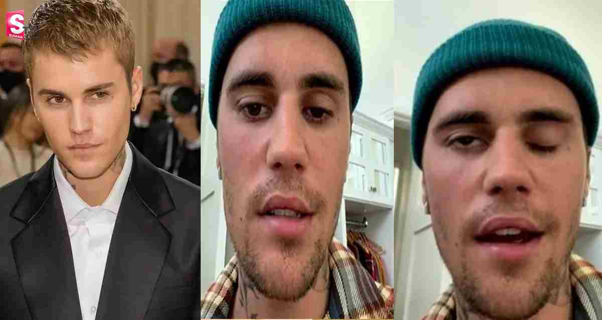 Justin Bieber Video: ప్రముఖ పాప్ సింగర్ జస్టిన్ బీబర్ కి పక్షవాతం! షాక్ లో ఫ్యాన్స్!