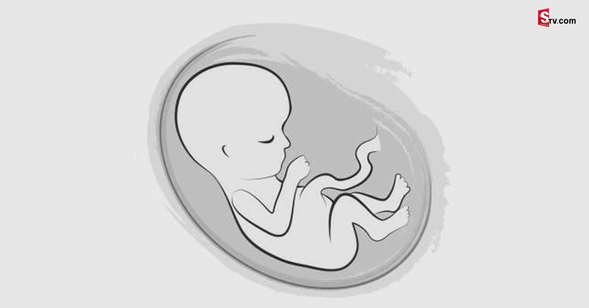 Infant: గర్భిణిపైనుంచి దూసుకెళ్లిన ట్రక్కు.. కడుపులోంచి బయటపడ్డ బిడ్డ!