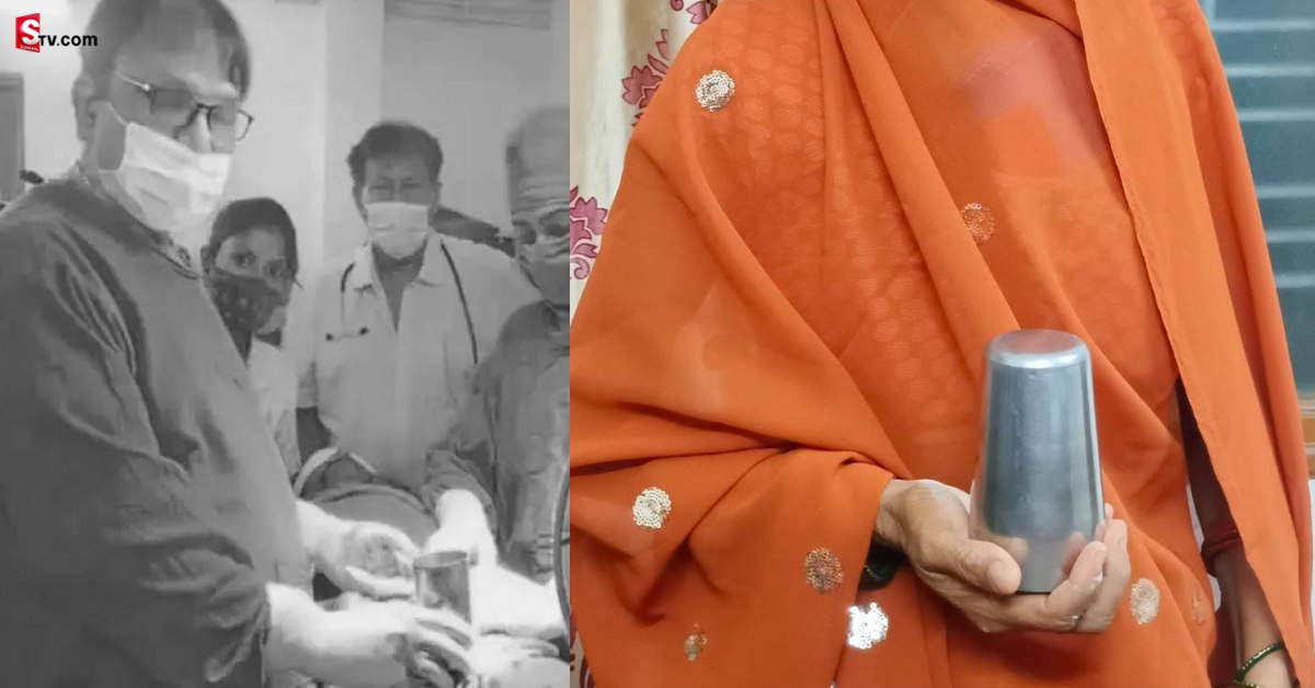 కడుపులోకి స్టీల్ గ్లాస్… సర్జరీ చేసి బయటకి తీసిన వైద్యులు! ఎలా వెళ్లిందంటే..