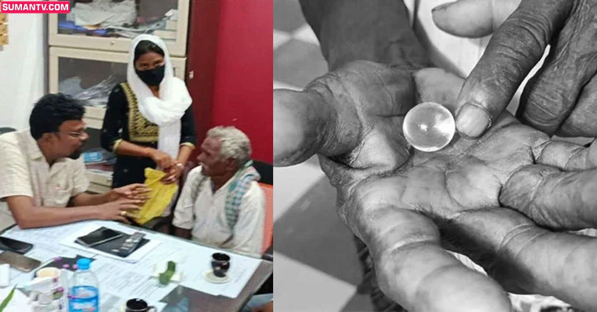 ఇది మీరు ఎక్కడా చూసుండరు.. కన్ను ఊడి చేతిలో పడింది!