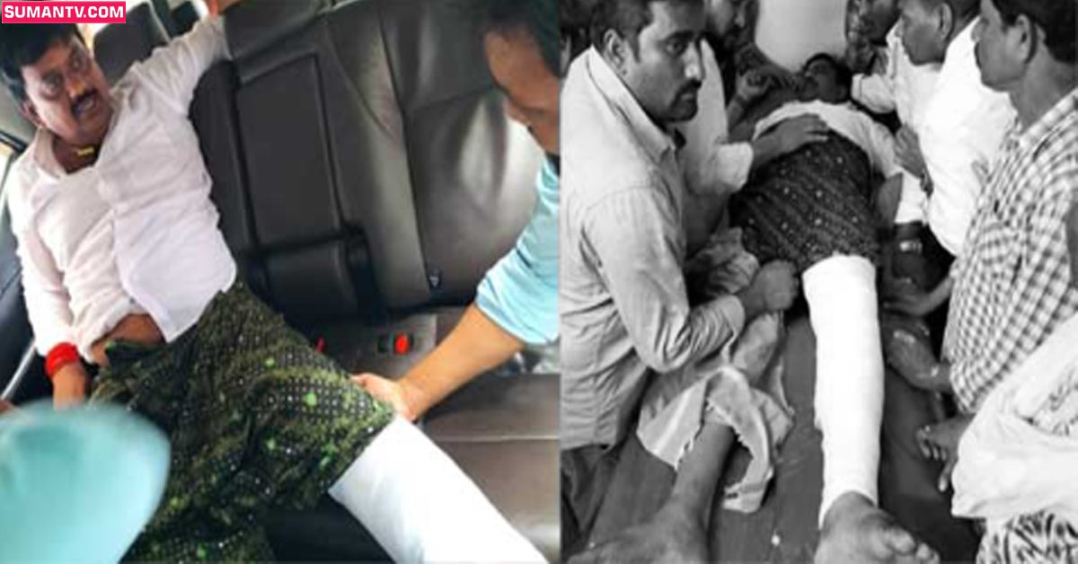 బ్రేకింగ్: బైక్ ర్యాలీలో వైసీపీ ఎమ్మెల్యే కి తీవ్రగాయాలు!