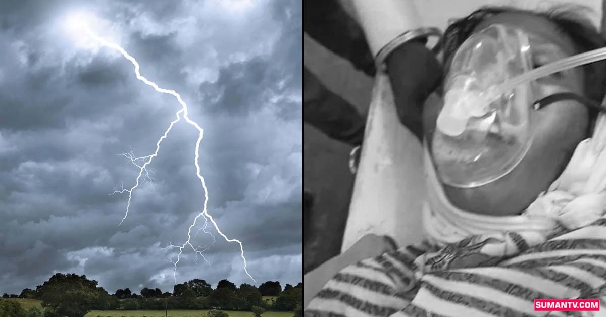 Lightning Strike: వామ్మో ఇదేంది.. పిడుగుపాటుకు మహిళ శరీరంపై ఉన్న బంగారం కరిగిపోయింది!