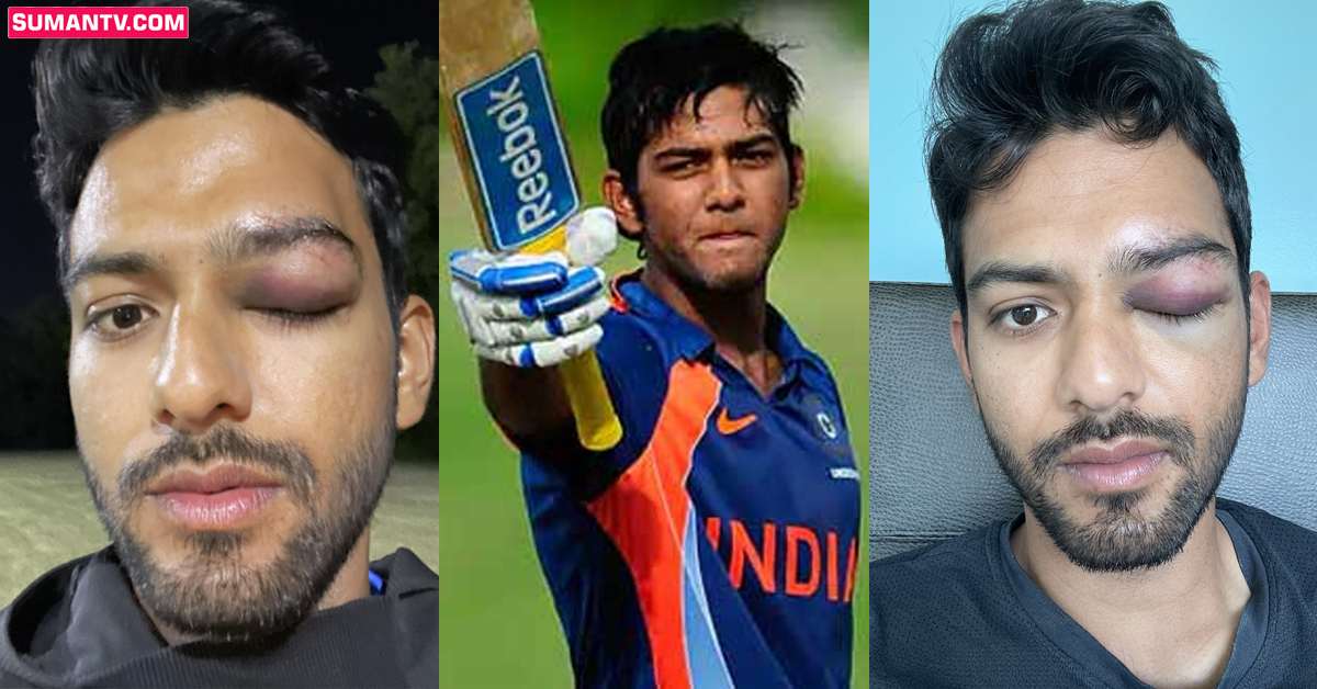 Unmukt Chand: తీవ్రంగా గాయపడిన భారత యువ క్రికెటర్ ఉన్ముక్త్ చంద్!