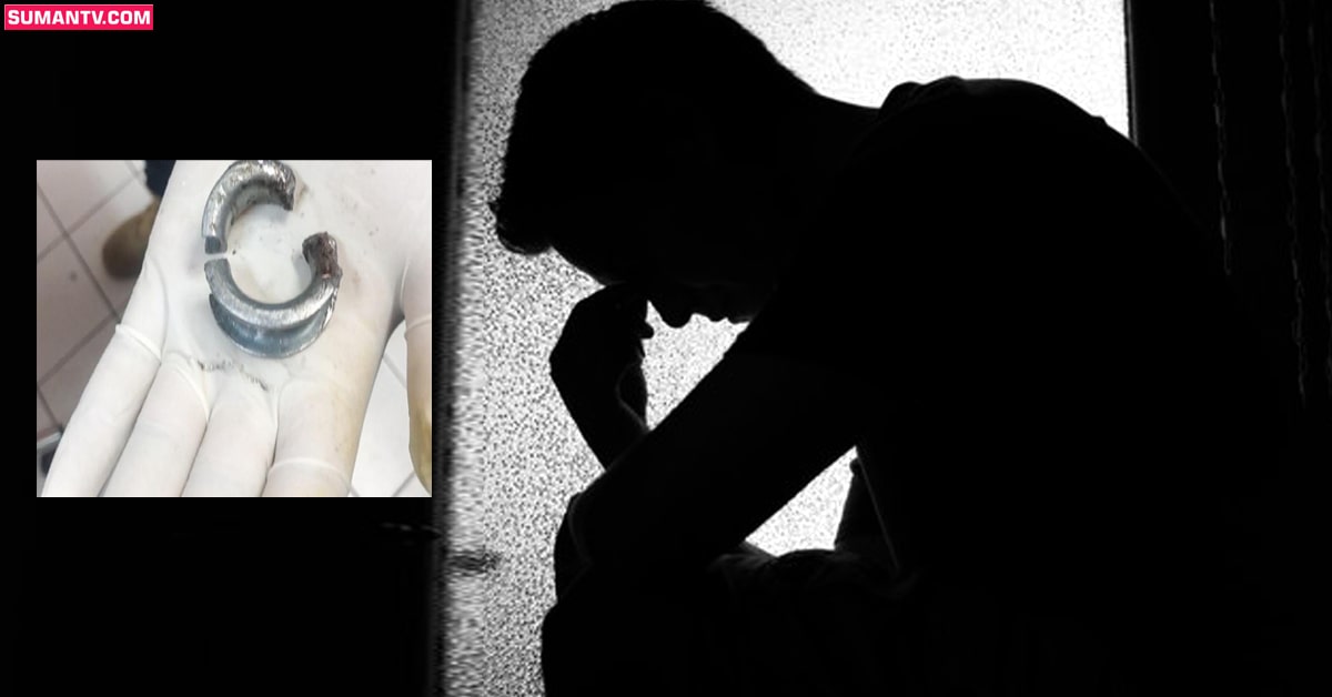 Metal Ring: మర్మాంగం అలా కావాలని దానికి రింగ్‌ తొడిగిన వ్యక్తి.. ప్రయోగం వికటించి..