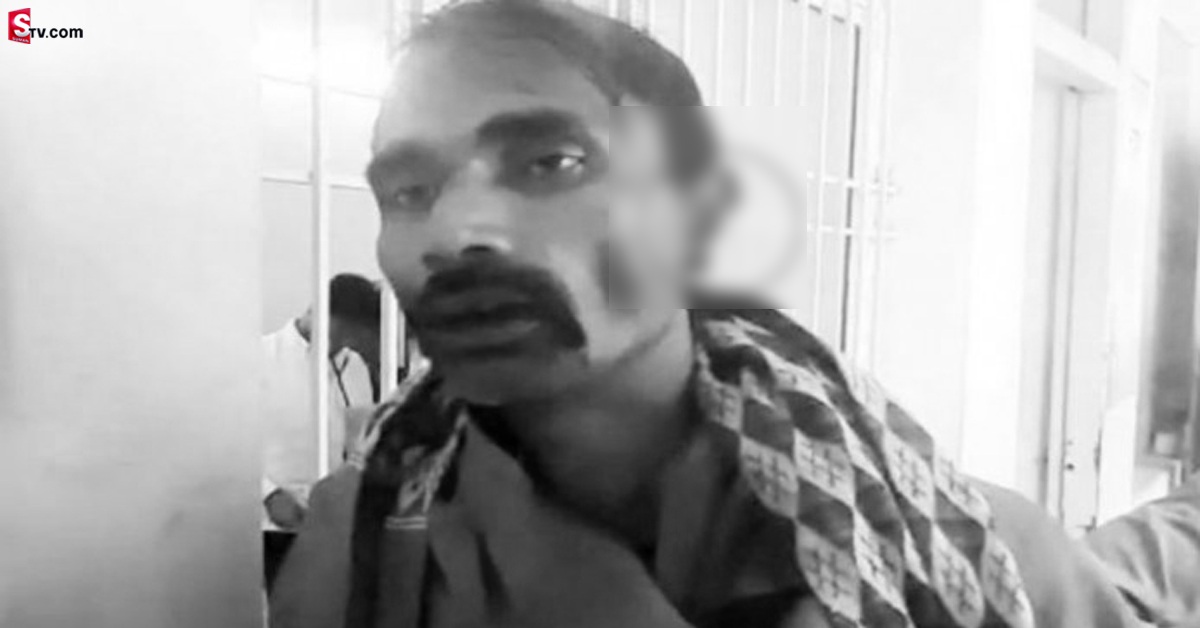 మృగంలా మారిన అల్లుడు.. మేనమామ చెవిని నమిలేశాడు!