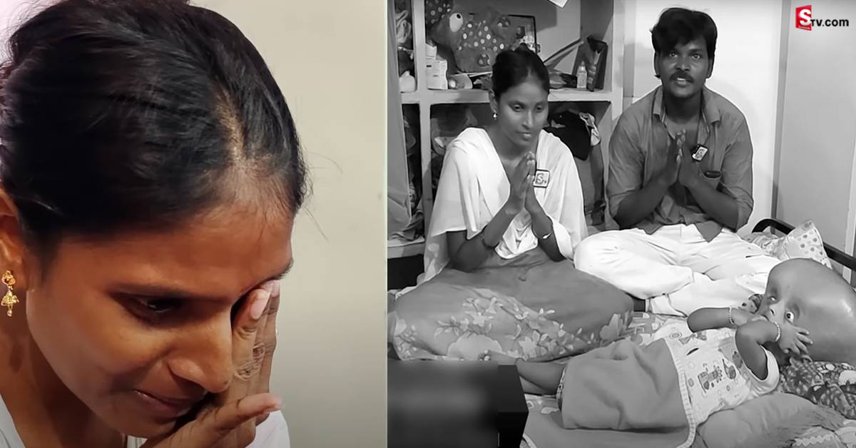 ఆ తల్లిదండ్రుల కష్టం ఎవ్వరికి వద్దు.. చిన్నారి వయసు 3 ఏళ్లు.. తల బరువు 10 కేజీలు!