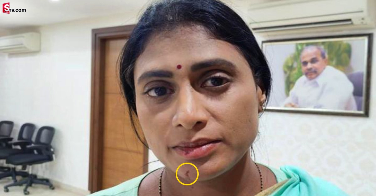 వీడియో: షర్మిల ముఖంపై గాయాలు.. ఈడ్చుకెళ్లి పోలీస్ వ్యాన్‌లో పడేశారంటూ ఫైర్!