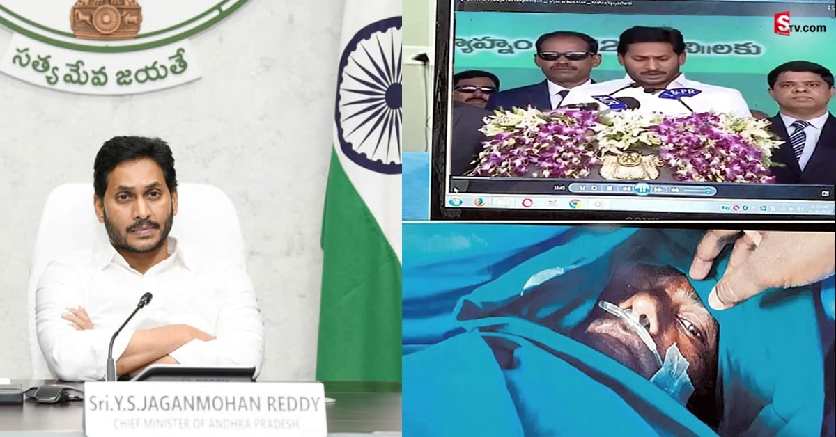 రోగికి.. సీఎం జగన్‌ ప్రమాణస్వీకారం వీడియో చూపిస్తూ సర్జరీ..!