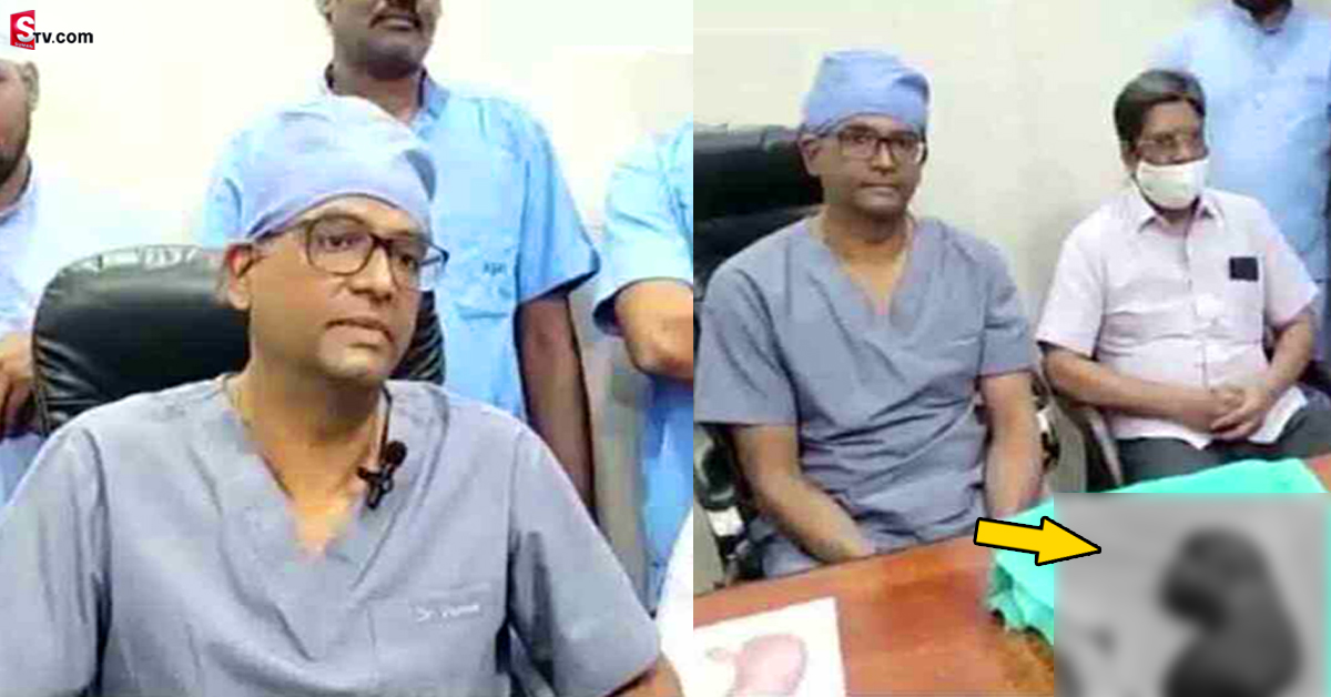 గుడివాడలో అరుదైన సర్జరీ.. బాలిక కడుపులో నుంచి ఏకంగా కిలో బరువైన..!