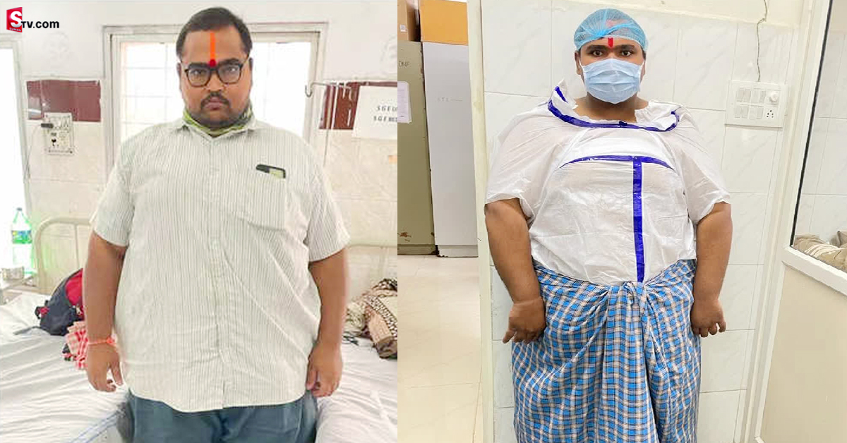 227 కిలోల బరువు ఉన్న వ్యక్తికి అరుదైన సర్జరీ.. 47 కిలోలు తగ్గించిన డాక్టర్లు!