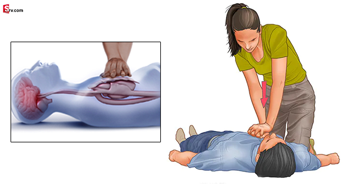 హార్ట్ ఎటాక్ వస్తే.. CPR ఎలా చేయాలి? తప్పక తెలుసుకోండి..