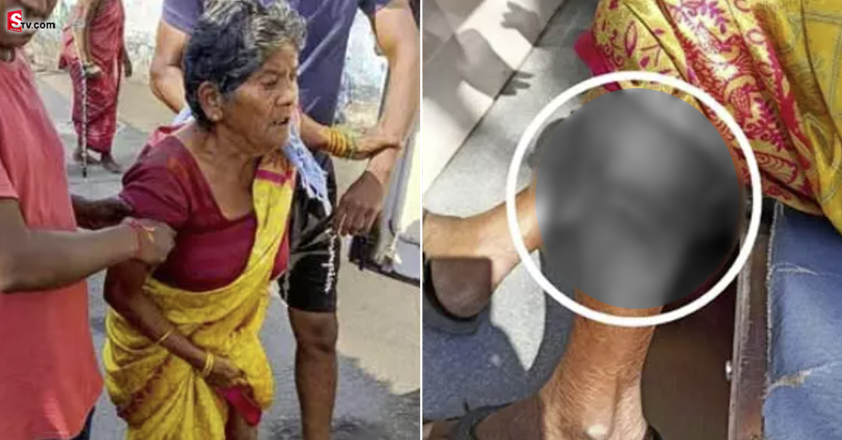 కుక్కల దాడిలో వృద్దురాలికి తీవ్ర గాయాలు..