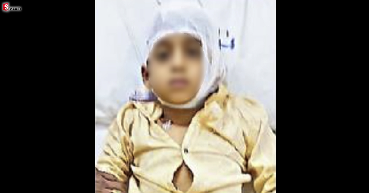 బాలుడిపై కుక్కల దాడి.. ప్రాణపాయ స్థితిలో ఆస్పత్రిలో చికిత్స!