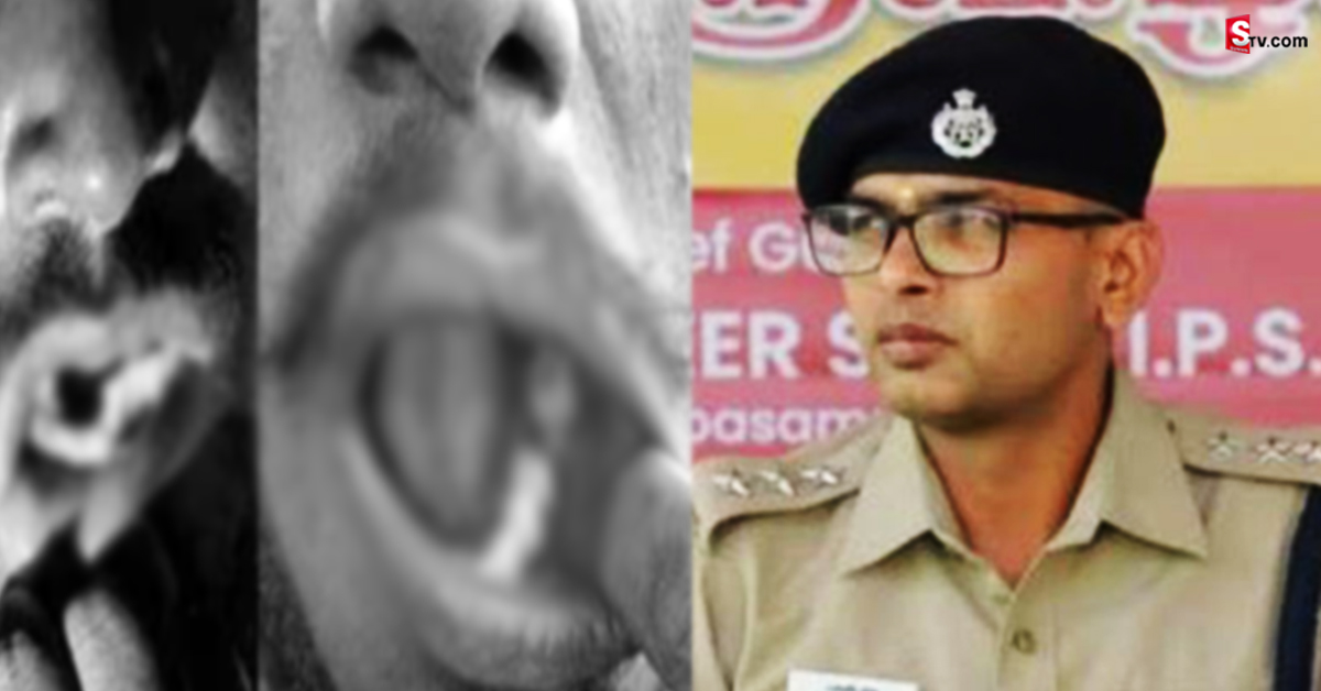బరితెగించిన ఐపీఎస్ అధికారి.. కటింగ్ ప్లేయర్ తో పళ్లు పీకి..!