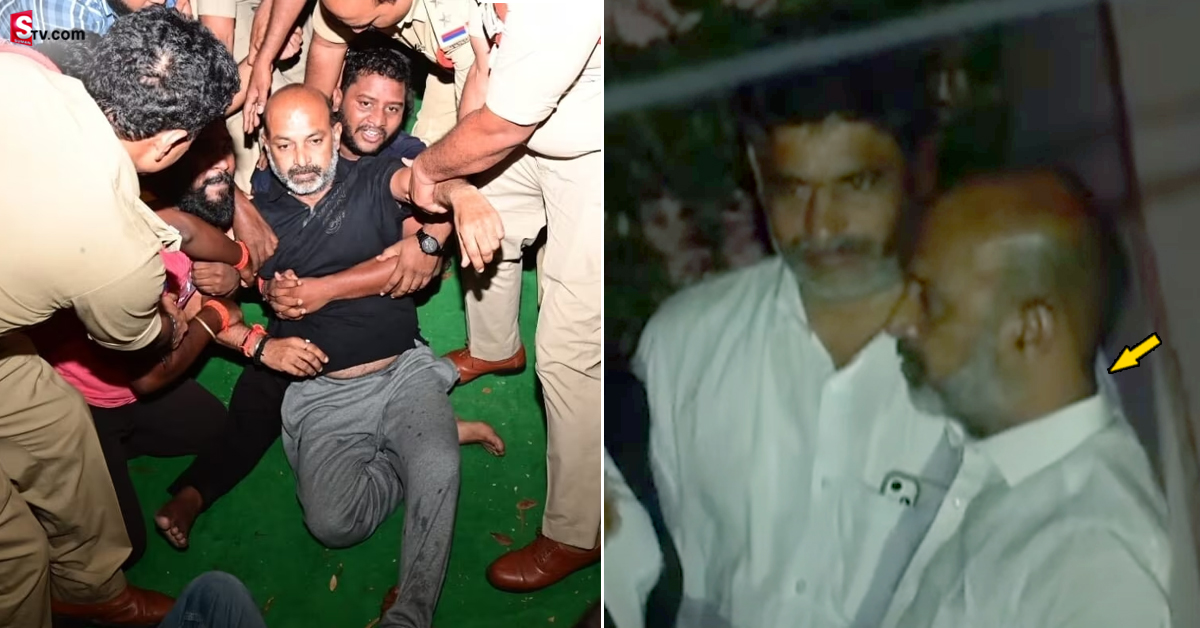 Bandi Sanjay:10th పేపర్ లీక్ కేసు: బండి సంజయ్ ఒంటిపై గాయాలు..!