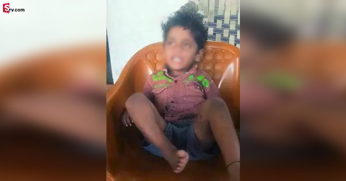 పుట్టిన రోజే బాలుడిపై వీధి కుక్కల దాడి.. తీవ్ర గాయాలు!
