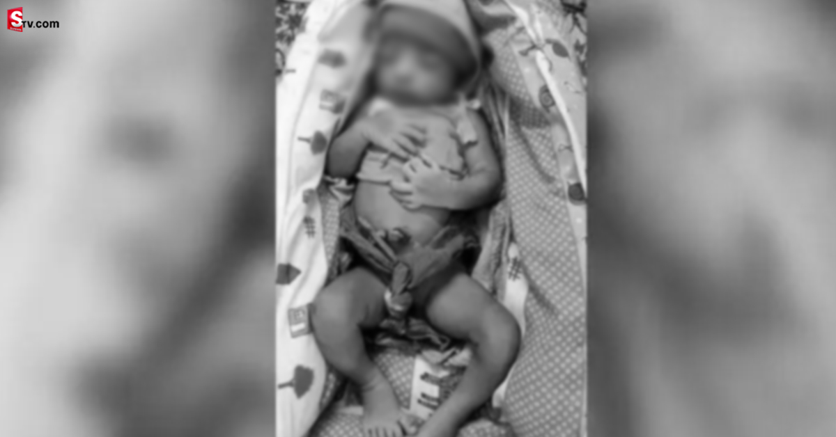 వింత ఘటన.. 24 వేళ్లతో శిశువు జననం