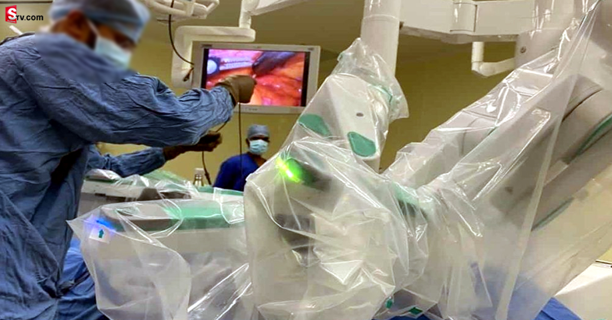 Robot-Associated CABG: రోబో సాయంతో గుండె ఆపరేషన్.. వైద్యుల అరుదైన ఘనత!
