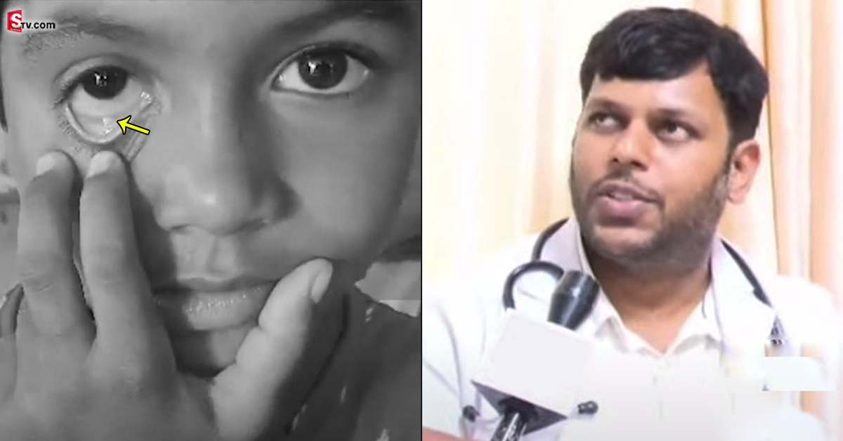 చిన్నారి కంటి నుంచి వస్తువులు.. వీడిన మిస్టరీ!