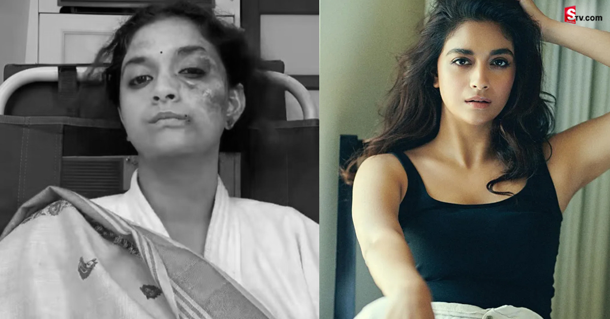 Keerthy Suresh: హీరోయిన్ కీర్తి సురేష్ ముఖంపై గాయాలు.. అసలేం జరిగింది?