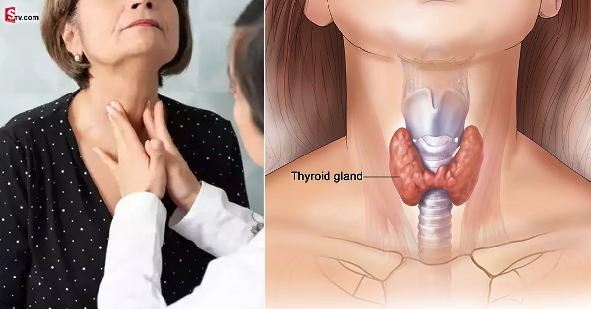Thyroid Symptoms in Telugu: ఈ లక్షణాలుంటే థైరాయిడ్‌ ఉన్నట్లే.. ఒక్క టెస్ట్‌తో సమస్యకు చెక్‌ పెట్టవచ్చు!