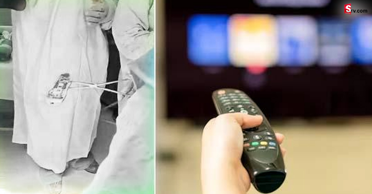 TV Remote: టీవీ రిమోట్‌ను మలద్వారంలో దాచిన ఘనుడు