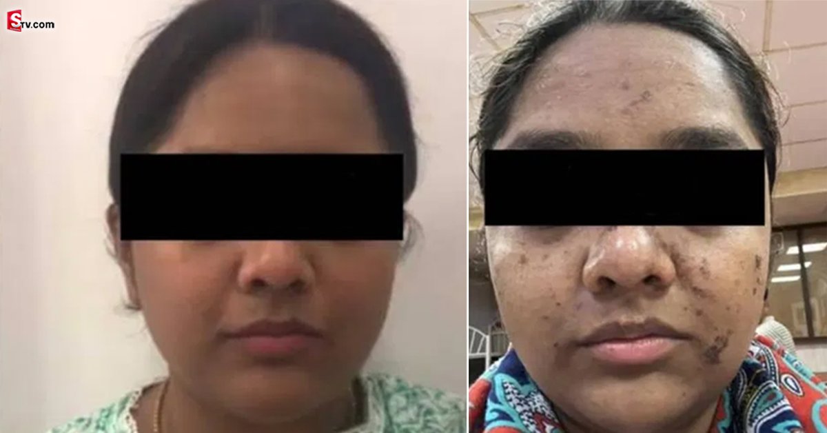 ఫేషియల్ చేయించుకుందామని సెలూన్‌కు వెళితే..