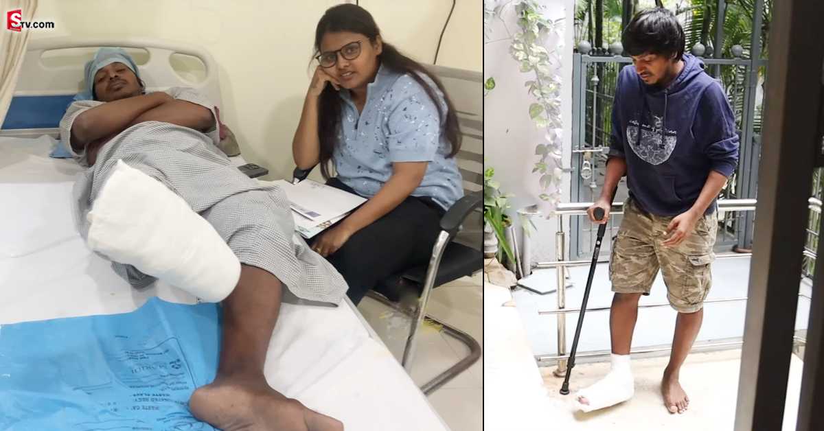 యాక్సిడెంట్ తరువాత యాదమ్మ రాజు పరిస్థితి! వేలు తీసేశారు!