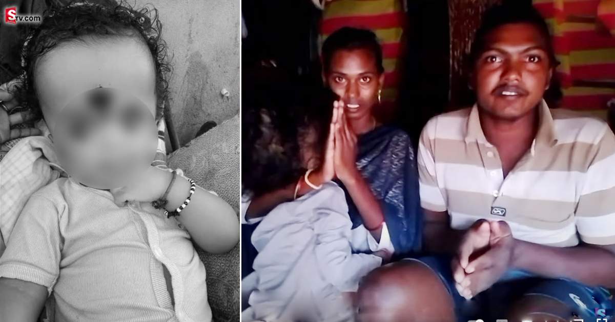 రోజు రోజుకి పెరుగుతున్న బాబు తల.. సాయం కోసం ఎదురుచూపులు