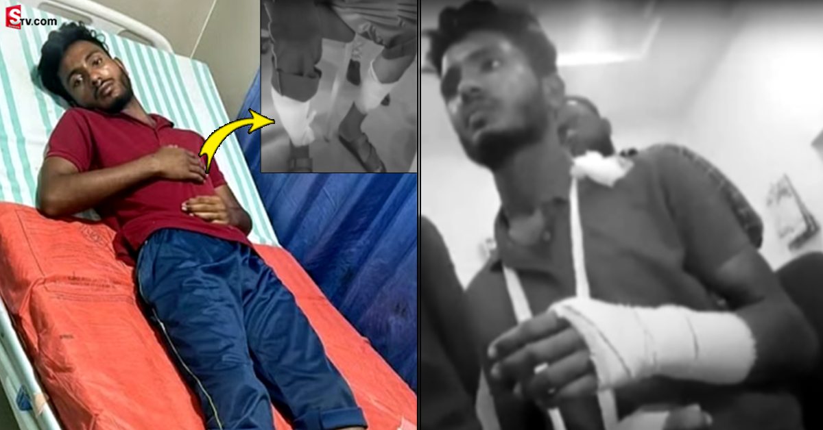 దారుణం.. డెలివరీ బాయ్ కాలు విరగొట్టిన కస్టమర్.. అసలు ఏం జరిగిందంటే?