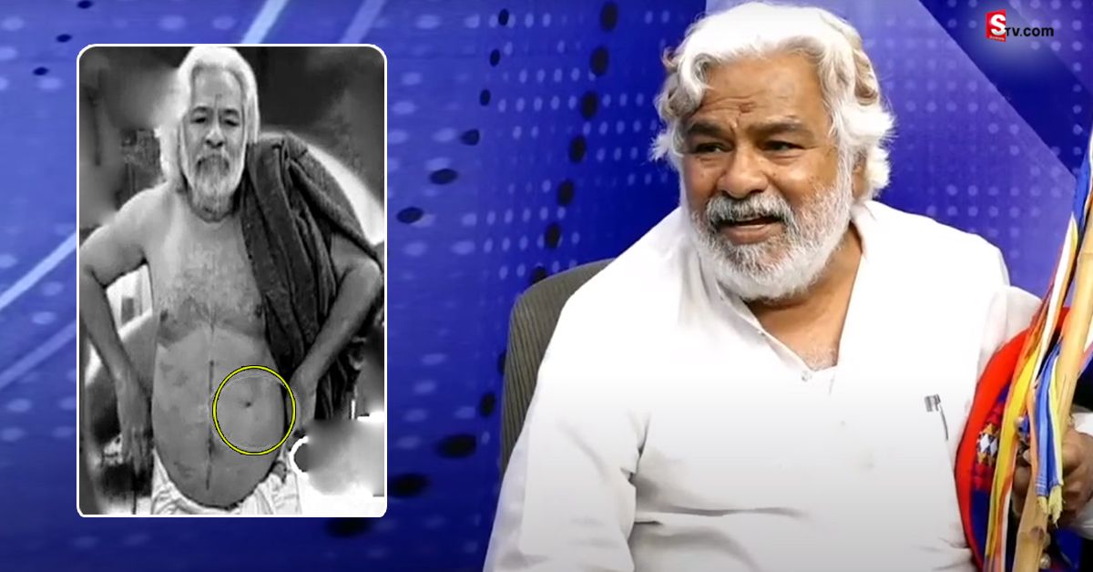 గద్దర్ ఛాతీలోకి దూసుకెళ్లిన తుపాకీ తూటాలు.. ఇప్పటికీ శరీరంలోనే ఉన్న బుల్లెట్..